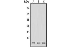 Western blot analysis of LY6E expression in HEK293T (A), Raw264. (LY6E anticorps  (Center))