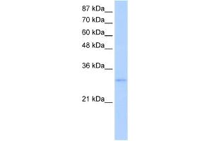 WB Suggested Anti-EXOSC6 Antibody Titration:  5. (EXOSC6 anticorps  (N-Term))