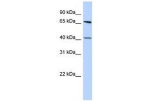 Image no. 1 for anti-Retinoblastoma Binding Protein 5 (RBBP5) (AA 431-480) antibody (ABIN6740370) (RBBP5 anticorps  (AA 431-480))
