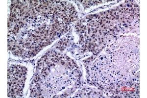 Immunohistochemistry (IHC) analysis of paraffin-embedded Human Lung, antibody was diluted at 1:100. (KLF13 anticorps)