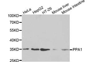 Western blot analysis of extracts of various cell lines, using PPA1 antibody. (Pyrophosphatase (Inorganic) 1 (PPA1) anticorps)