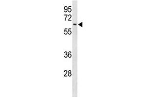 Western blot analysis of EIF2A antibody and Ramos lysate.