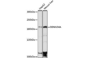 Western blot analysis of extracts of various cell lines, using DENND4A antibody (ABIN7266729) at 1:1000 dilution. (DENND4A anticorps  (AA 1500-1650))