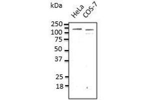Endogenous CDHI detected with anti-CDH1at 1/500 dilution, lysate at 100 µg per Iane and rabbit polyclonal to goat lgG (HRP) at 1/10,00 dilution. (E-cadherin anticorps)