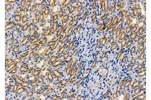 ABIN6262851 and ABIN6277626 at 1/100 staining Rat kidney tissue by IHC-P. (Kallikrein 7 anticorps  (Internal Region))