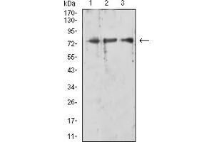 Western blot analysis using RIPK1 mouse mAb against HL-60 (1), K562 (2), and Jurkat (3) cell lysate. (RIPK1 anticorps  (AA 131-277))