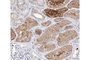 ABIN6266730 at 1/100 staining human kidney tissue sections by IHC-P. (TRIM16 anticorps  (N-Term))