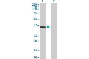 Western Blot analysis of BRDG1 expression in transfected 293T cell line by BRDG1 monoclonal antibody (M01), clone 5A10. (STAP1 anticorps  (AA 186-293))