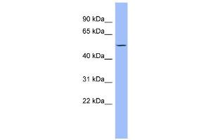 WB Suggested Anti-PTK6 Antibody Titration: 0. (PTK6 anticorps  (Middle Region))