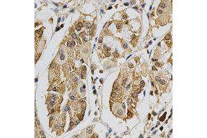 Immunohistochemistry of paraffin-embedded human stomach using MAPK10 antibody at dilution of 1:200 (x400 lens) (MAPK10 anticorps  (AA 175-464))