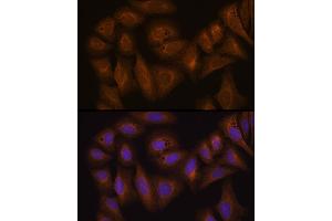 Immunofluorescence analysis of U-2 OS cells using GST Rabbit pAb (8266) at dilution of 1:100 (40x lens). (GSTA1 anticorps  (AA 1-222))