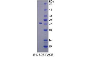 SDS-PAGE (SDS) image for Metalloproteinase Inhibitor 2 (TIMP2) (AA 27-220) protein (His tag) (ABIN1080958)