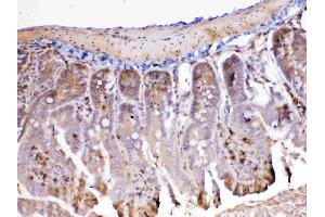 IHC analysis of ADA using anti-ADA antibody .