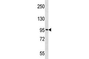 PROX1 antibody western blot analysis in A2058 lysate