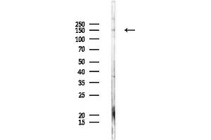 Western blot analysis of lysates from Rat liver, using ADAMTS13 Antibody at 1/1000 dilution.