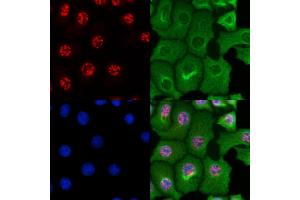 ABIN6264437 and ABIN6269102 staining HepG2 cells by IF/ICC. (Progesterone Receptor anticorps)