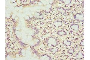 Immunohistochemistry of paraffin-embedded human small intestine tissue using ABIN7159380 at dilution of 1:100 (MBTPS1 anticorps  (AA 803-1052))