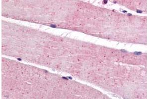 Immunohistochemistry (Formalin/PFA-fixed paraffin-embedded sections) of human skeletal muscle tissue with BEST3 polyclonal antibody . (Bestrophin 3 anticorps  (C-Term))