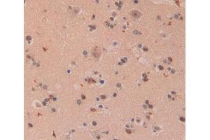 IHC-P analysis of brain tissue, with DAB staining. (XPO5 anticorps  (AA 2-180))