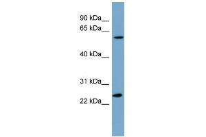 WB Suggested Anti-LRRC6 Antibody Titration: 0. (LRRC6 anticorps  (N-Term))