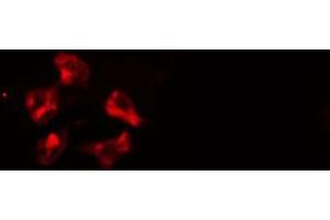 ABIN6277118 staining  HeLa cells by IF/ICC.