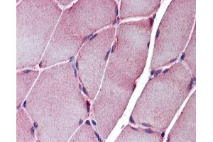 Immunohistochemistry (IHC) image for anti-Sarcoglycan, epsilon (SGCE) (N-Term) antibody (ABIN2782610)