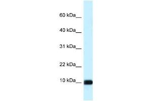 Western Blot showing CALML3 antibody used at a concentration of 1 ug/ml against Hela Cell Lysate (CALML3 anticorps  (Middle Region))