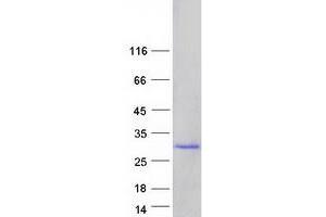 Validation with Western Blot