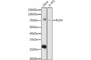Western blot analysis of extracts of various cell lines, using FLCN antibody (ABIN6133517, ABIN6140670, ABIN6140672 and ABIN6222156) at 1:1000 dilution. (FLCN anticorps  (AA 1-342))