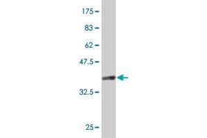 Western Blot detection against Immunogen (37 KDa) .