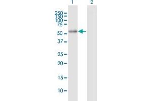 Western Blot analysis of ALDH7A1 expression in transfected 293T cell line by ALDH7A1 MaxPab polyclonal antibody. (ALDH7A1 anticorps  (AA 1-511))