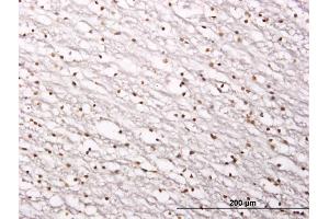 Immunoperoxidase of monoclonal antibody to SIRT1 on formalin-fixed paraffin-embedded human lateral ventricle wall. (SIRT1 anticorps  (AA 456-555))