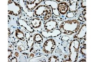 Immunohistochemical staining of paraffin-embedded Kidney tissue using anti-KIAA1609 mouse monoclonal antibody. (KIAA1609 anticorps)