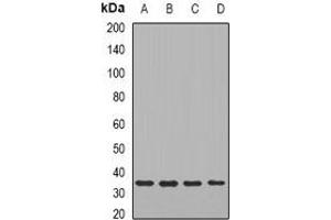 Western blot analysis of TIRAP expression in HT29 (A), SW480 (B), mouse liver (C), mouse brain (D) whole cell lysates. (TIRAP anticorps)