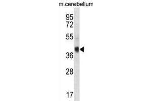 Western Blotting (WB) image for anti-AKT Interacting Protein (AKTIP) antibody (ABIN3000901) (AKTIP anticorps)