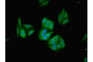 Immunofluorescent analysis of HepG2 cells using ABIN7154951 at dilution of 1:100 and Alexa Fluor 488-congugated AffiniPure Goat Anti-Rabbit IgG(H+L)