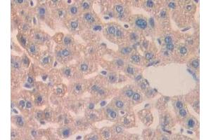 Detection of CA5B in Mouse Liver Tissue using Polyclonal Antibody to Carbonic Anhydrase VB, Mitochondrial (CA5B)