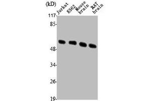 Western Blot analysis of Jurkat K562 MOUSE-BRAIN RAT-BRAIN cells using Tubulin β Polyclonal Antibody (TUBB3 anticorps  (C-Term))
