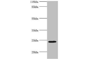 Western blot All lanes: MIS12 antibody at 2 μg/mL + Hela whole cell lysate Secondary Goat polyclonal to rabbit IgG at 1/10000 dilution Predicted band size: 25 kDa Observed band size: 25 kDa (MIS12 anticorps  (AA 1-305))