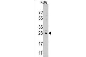 Western Blotting (WB) image for anti-Lin-28 Homolog B (LIN28B) antibody (ABIN2937586) (LIN28B anticorps)