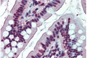 Human Small Intestine: Formalin-Fixed, Paraffin-Embedded (FFPE) (EWSR1 anticorps  (AA 201-215))