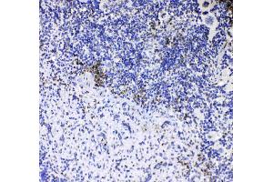 IHC analysis of CD8 alpha using anti-CD8 alpha antibody .