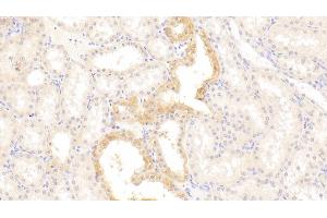 Detection of ADIPOR2 in Human Kidney Tissue using Polyclonal Antibody to Adiponectin Receptor 2 (ADIPOR2)