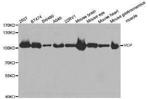 Western blot analysis of extracts of various cell lines, using VCP antibody. (VCP anticorps)