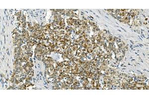 IHC analysis of IDH2 using anti-IDH2 antibody (ABIN7602786). (IDH2 anticorps  (C-Term))