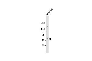 Anti-SLC6A8 Antibody (N-Term) at 1:2000 dilution + mouse heart lysate Lysates/proteins at 20 μg per lane.