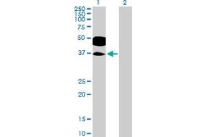 Western Blot analysis of RHOXF2 expression in transfected 293T cell line by RHOXF2 MaxPab polyclonal antibody. (RHOXF2 anticorps  (AA 1-288))