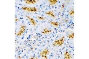 Immunohistochemistry (IHC) image for anti-WNK Lysine Deficient Protein Kinase 3 (WNK3) antibody (ABIN7308502)