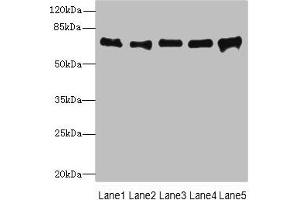Western blot All lanes: SPDL1 antibody at 4 μg/mL Lane 1: Hela whole cell lysate Lane 2: 293T whole cell lysate Lane 3: Jurkat whole cell lysate Lane 4: A549 whole cell lysate Lane 5: K562 whole cell lysate Secondary Goat polyclonal to rabbit IgG at 1/10000 dilution Predicted band size: 71, 59, 62 kDa Observed band size: 71 kDa (CCDC99 anticorps  (AA 1-300))
