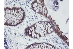 Image no. 6 for anti-Interferon Regulatory Factor 6 (IRF6) antibody (ABIN1498901)